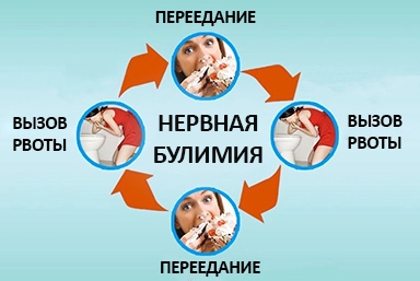 Лечение булимии в Шатках